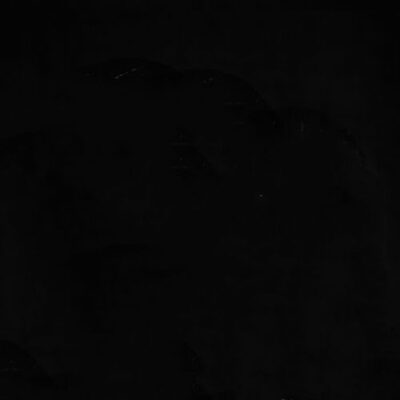 Traumazine