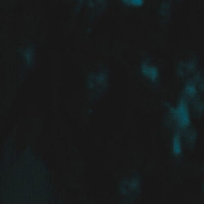 HISTORY (Deluxe)
